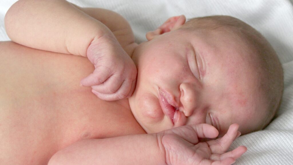 URPS Sages-femmes webinaire Fentes labio palatine annonce anté ou post natal d’une malformation