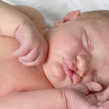 URPS Sages-femmes webinaire Fentes labio palatine annonce anté ou post natal d’une malformation